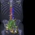 Is Nuclear Medicine Safer Than CT Scans?