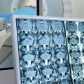 Are Nuclear Scans Safe? An Expert's Perspective