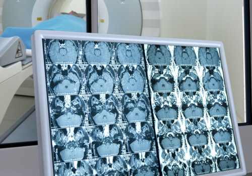 Are Nuclear Scans Safe? An Expert's Perspective